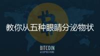 教你从五种眼睛分泌物状况 辨别身体疾病