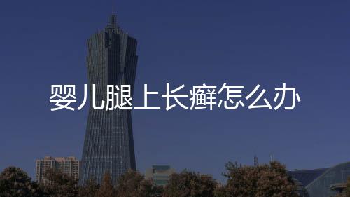 婴儿腿上长癣怎么办
